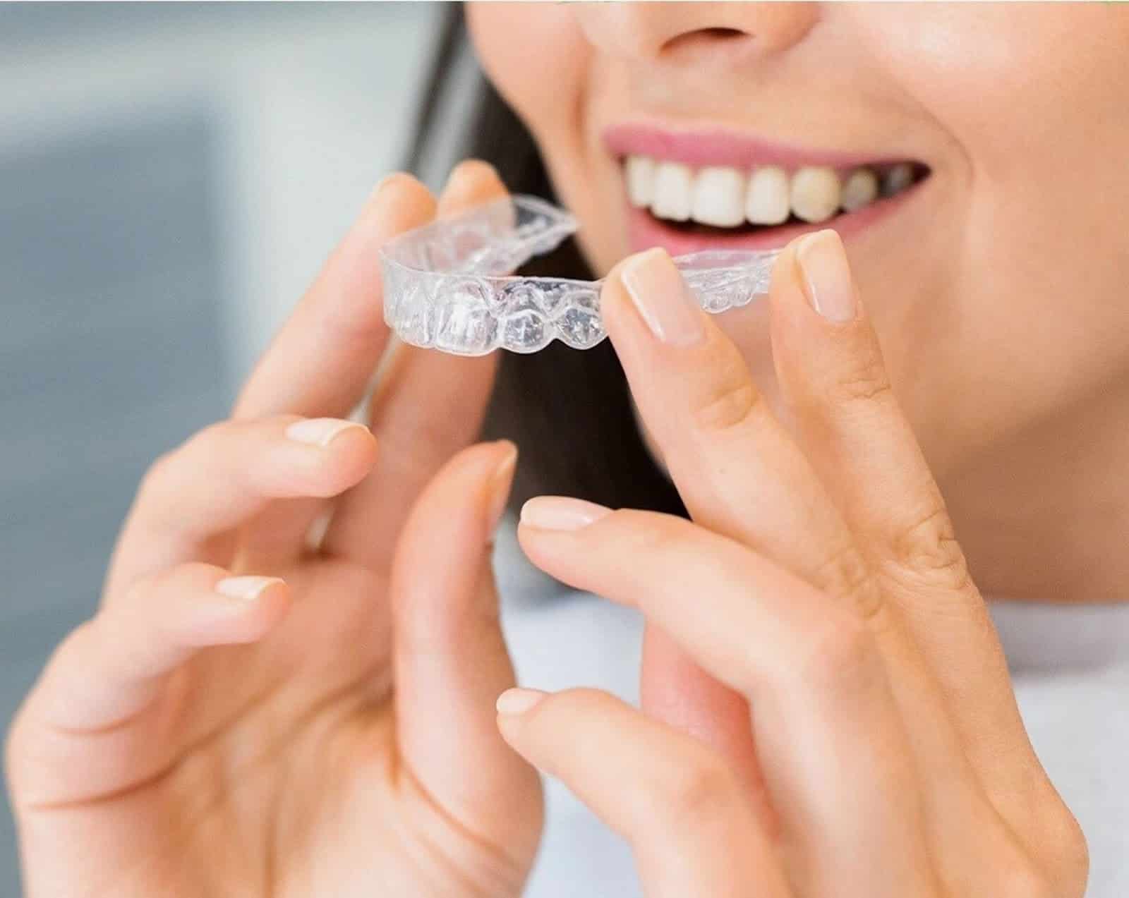 Clear Alligners Vs Braces 2